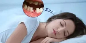 Nằm Mơ Rụng 1 Cái Răng Đánh Đề Con Gì Chính Xác Nhất